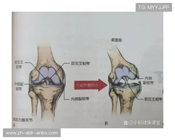 球星伤情速递王凡懿右膝内侧副韧带损伤康复期预计两至三周